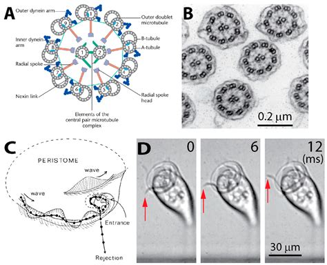 Vorticella! Een microscopisch wonder dat zich voortbeweegt door trilhaar-gebasseerde golfslagbewegingen en een stengelachtige structuur gebruikt voor aanhechting.