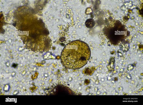  Arcella! Een microscopische meester van camouflage en architectuur