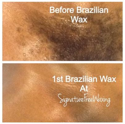 Can You Swim After a Brazilian Wax? And Other Mysteries of Post-Wax Life