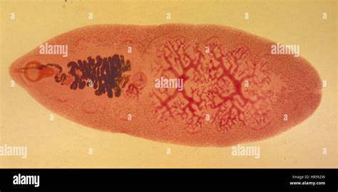  Giant Intestinal Fluke: Discover This Master of Disguise Living Within Our Guts!