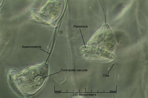  Vorticella! De hypnotiserende werveling van een microscopisch wonder